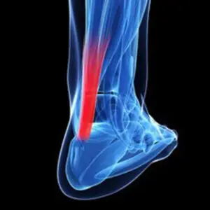Tendons & Ligaments