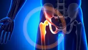 Hip Examination and Diagnosis: A Practical Approach to Accurate Assessment of Hip Pathology