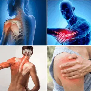 The Elbow and Rotator Cuff Bundle