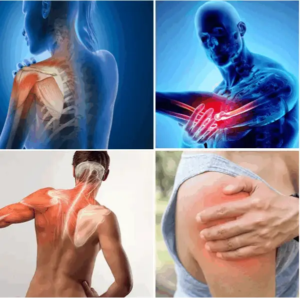 The Elbow and Rotator Cuff Bundle